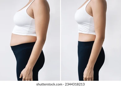 affecting liposuction cost 