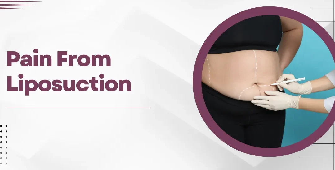 Pain from Liposuction: What You Need to Know