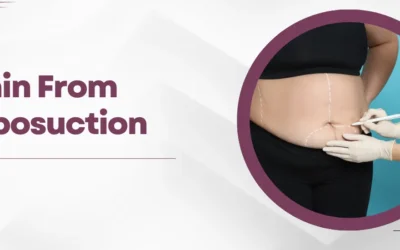 Pain from Liposuction: What You Need to Know