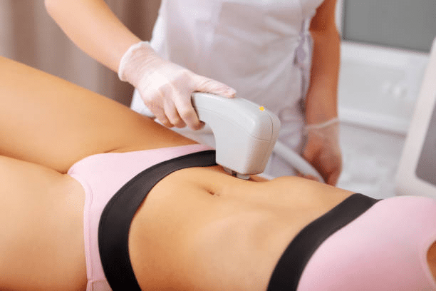 Laser-Assisted Liposuction (SmartLipo)